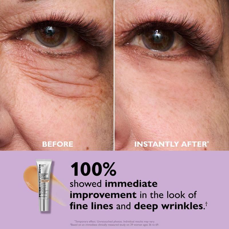 Eye Cream for Wrinkles – Instant Tightening &amp; Firming Treatment